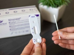 Preocupaci&oacute;n de bioqu&iacute;micos por la implementaci&oacute;n del Auotest de COVID-19